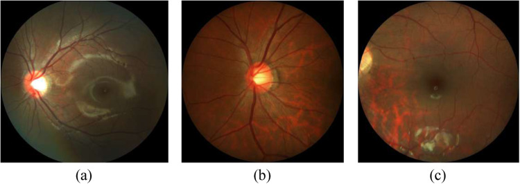 Fig. 2