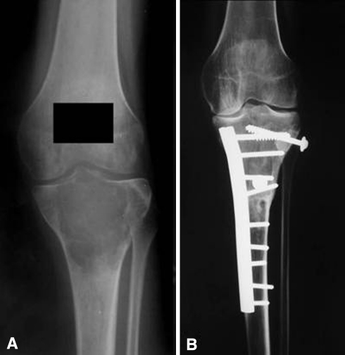 Fig. 1A–B