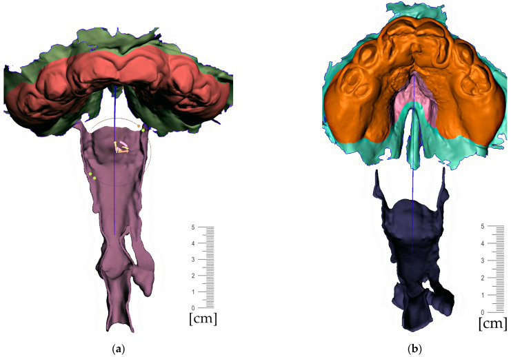 Figure 11