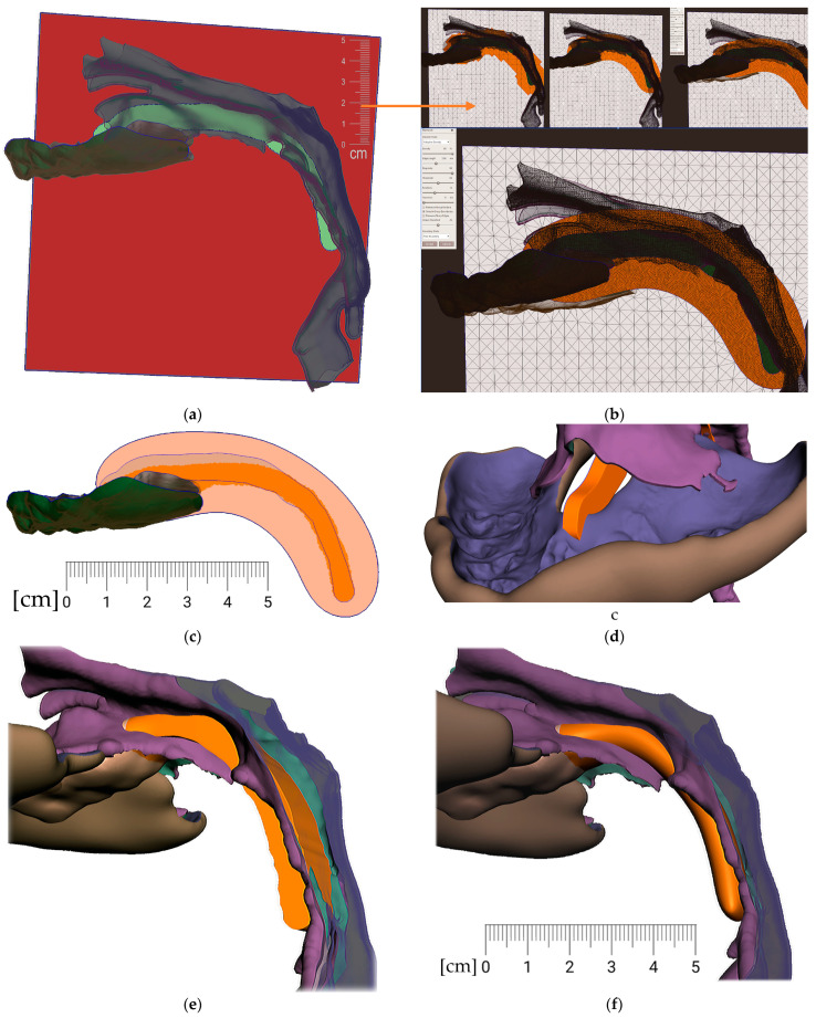 Figure 12