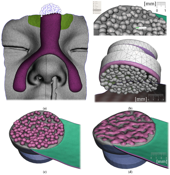 Figure 17