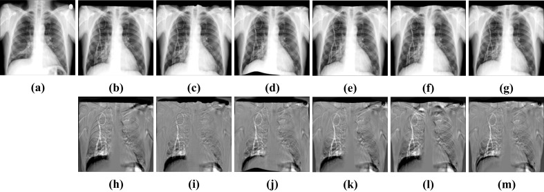 Fig. 16