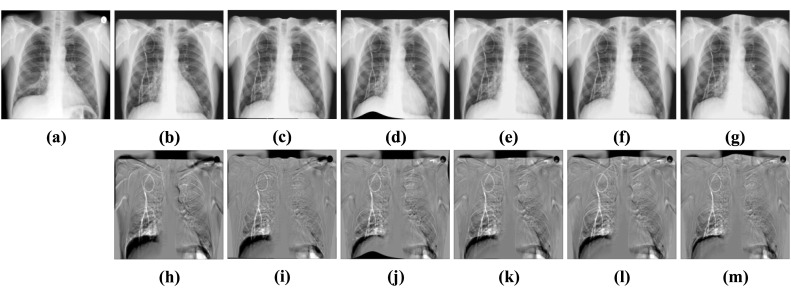 Fig. 10