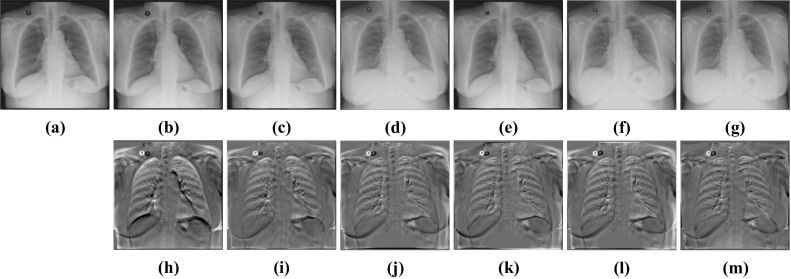 Fig. 11