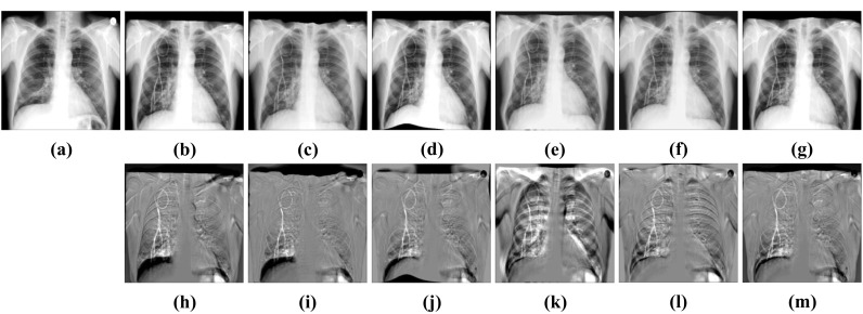 Fig. 13