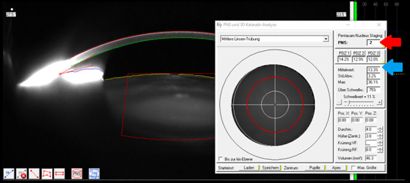 Fig 1