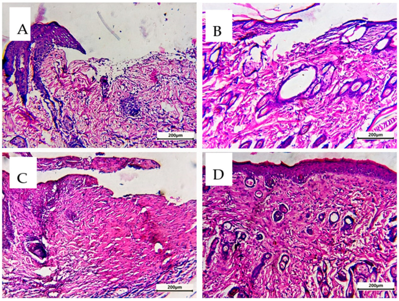 Figure 13