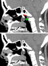 Fig. 1