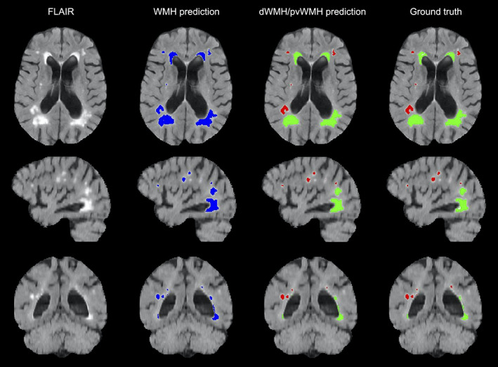 FIGURE 6