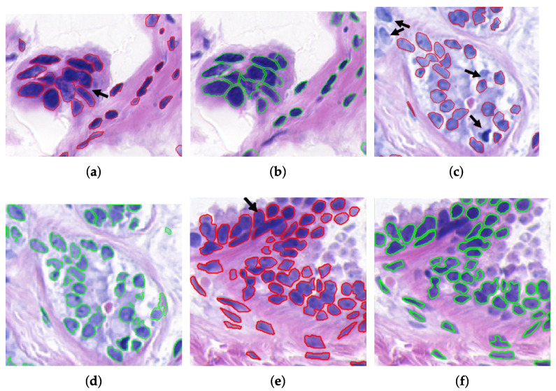 Figure 13