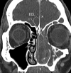 Fig 3.