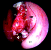 Fig 5.