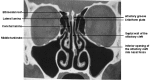 Fig 1.