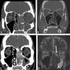 Fig 6.