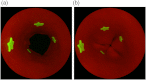 Fig. 11