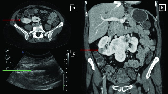 Fig 2.