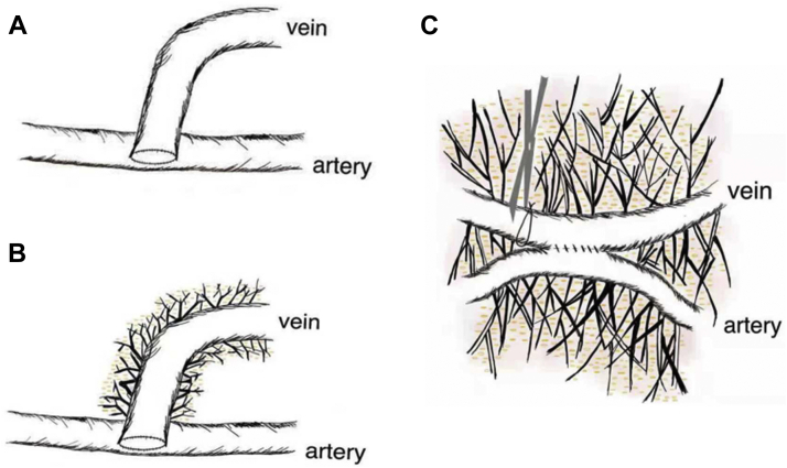 Fig 1