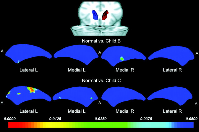 Fig 3.