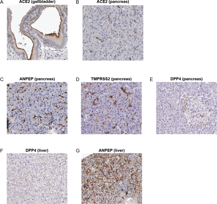 Figure 2—figure supplement 11.