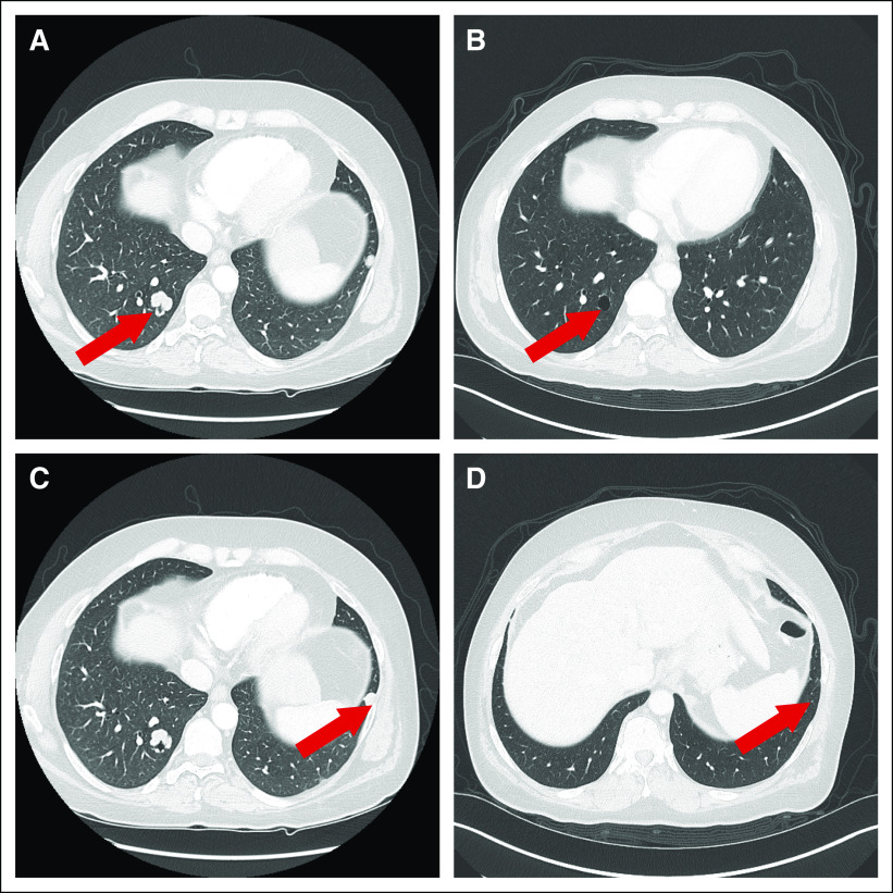 Fig 3.