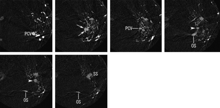 Fig 2.