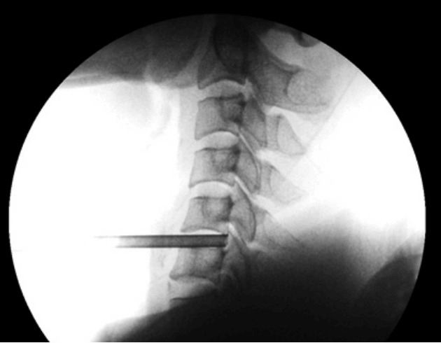 Fig. 15
