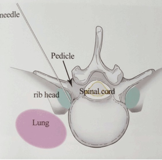 Fig. 27