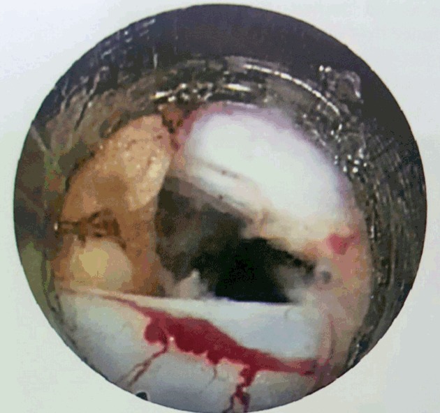 Fig. 11