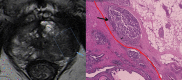 Fig. 12