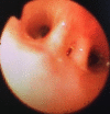 Fig. 5
