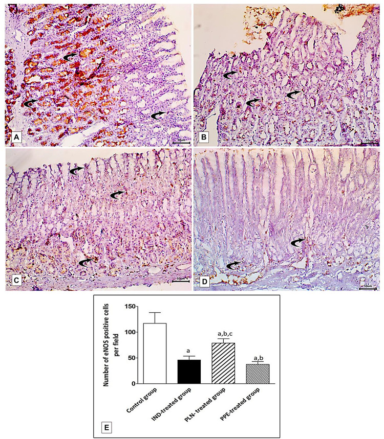 FIGURE 13