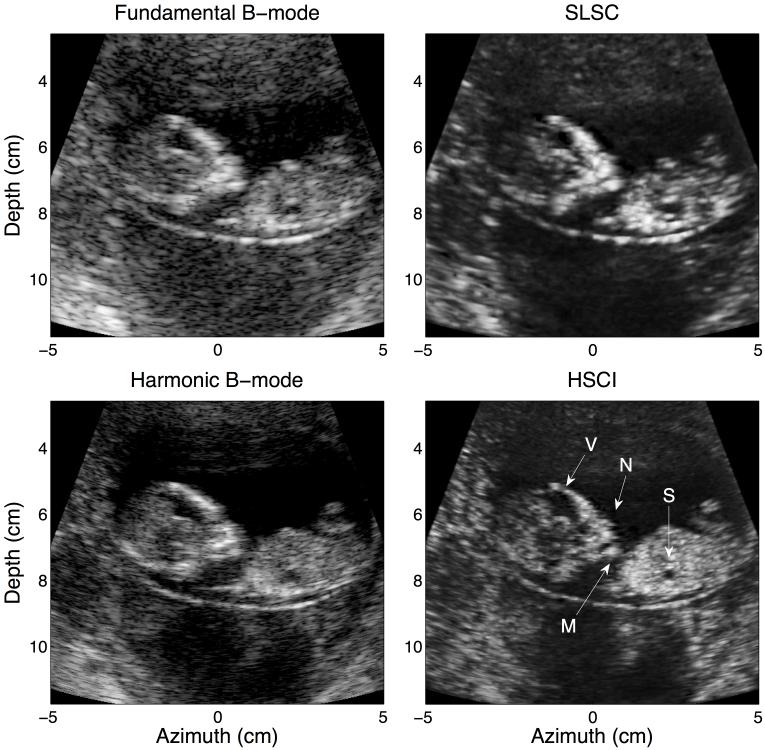 FIG. 1