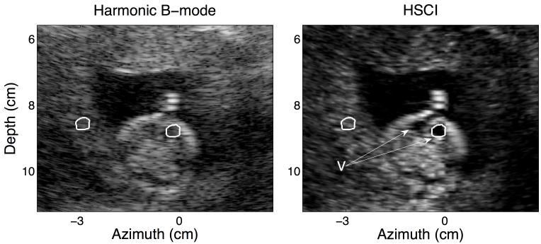 FIG. 5