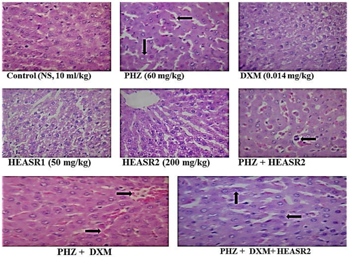 Figure 11.