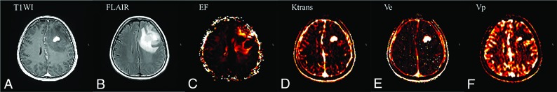 Fig 2.