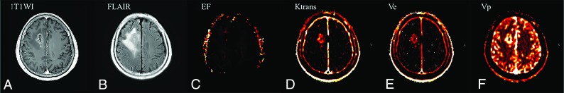 Fig 1.