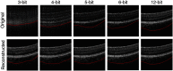 Fig. 11