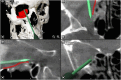 Figure 18.