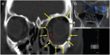 Figure 26.