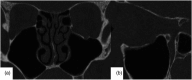 Figure 25.