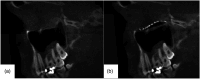 Figure 14.
