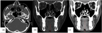 Figure 23.