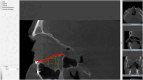 Figure 19.