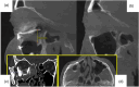 Figure 21.