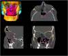 Figure 10.