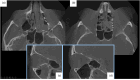 Figure 22.
