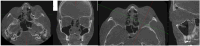 Figure 24.