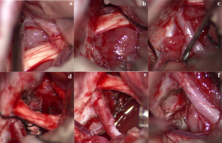 Fig. 3