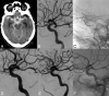 Fig 2.