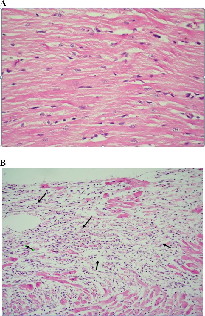 Figure 3A